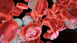 Polycythemia Vera: Causes, Symptoms, Diagnosis and Treatment