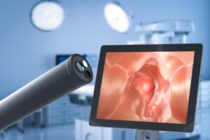The Surgery to Treat Gastroesophageal Reflux Disease