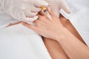 Hand Rejuvenation: What Are The Recommended Techniques?