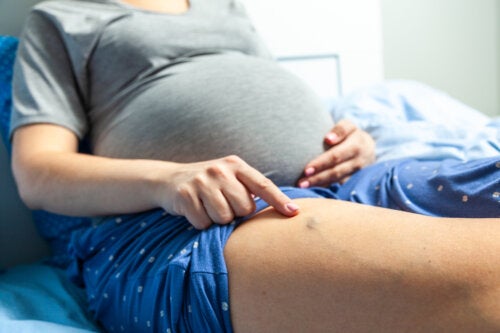 Phlebitis in Pregnancy: Symptoms and Treatment