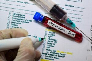 Fibrinogen Blood Test: Functions and Results