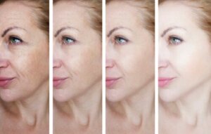 Cellular Renewal: The Key to Youthful-Looking Skin