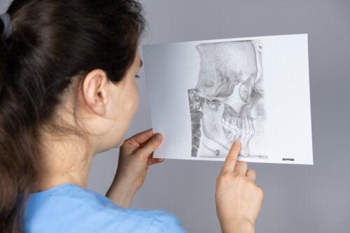 What’s mandibular retrognathia and the way is it treated?