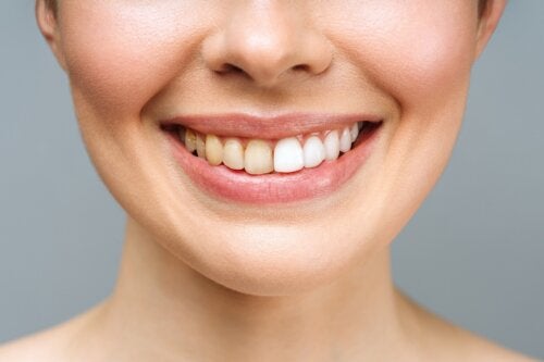 New TikTok Challenge Puts Dental Health at Risk