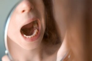 Papilloma in The Mouth: Signs and Prevention