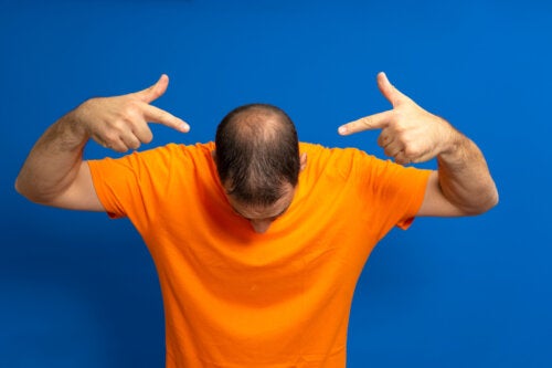 a guide to forestall baldness