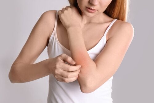 Neurodermatitis: Causes, Symptoms and Treatment