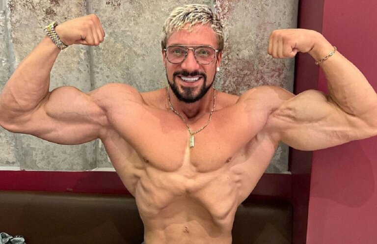 Brain Aneurysm: Cause of Death of Influencer and Bodybuilder Jo Lindner