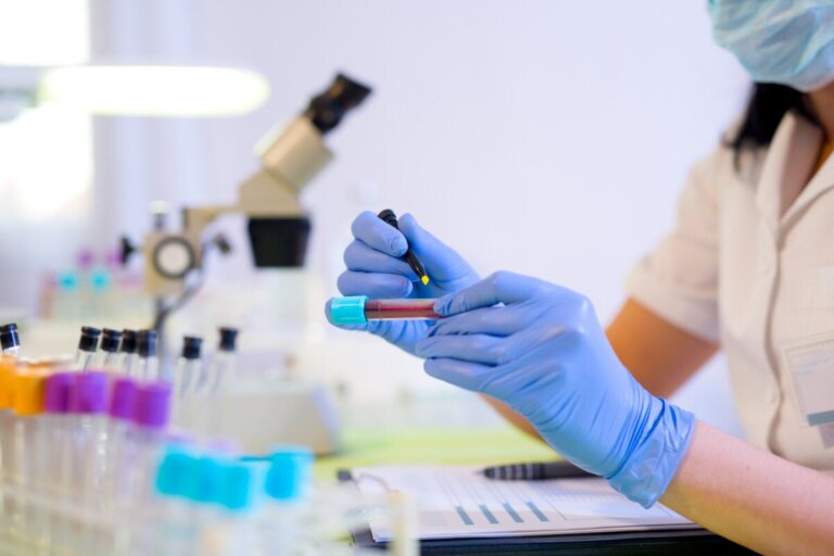 High or Low RDW in Blood Count: What Does It Mean?