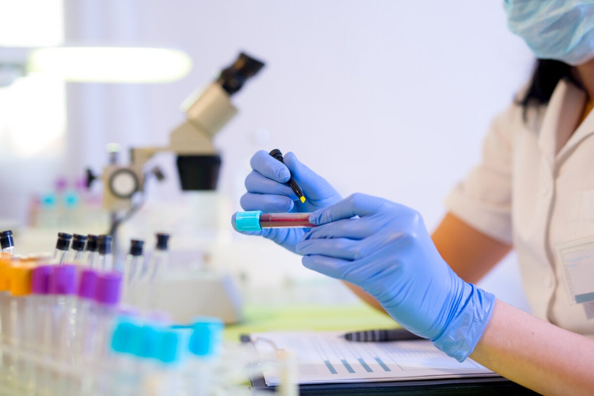 High or Low RDW in Blood Count: What Does It Mean?