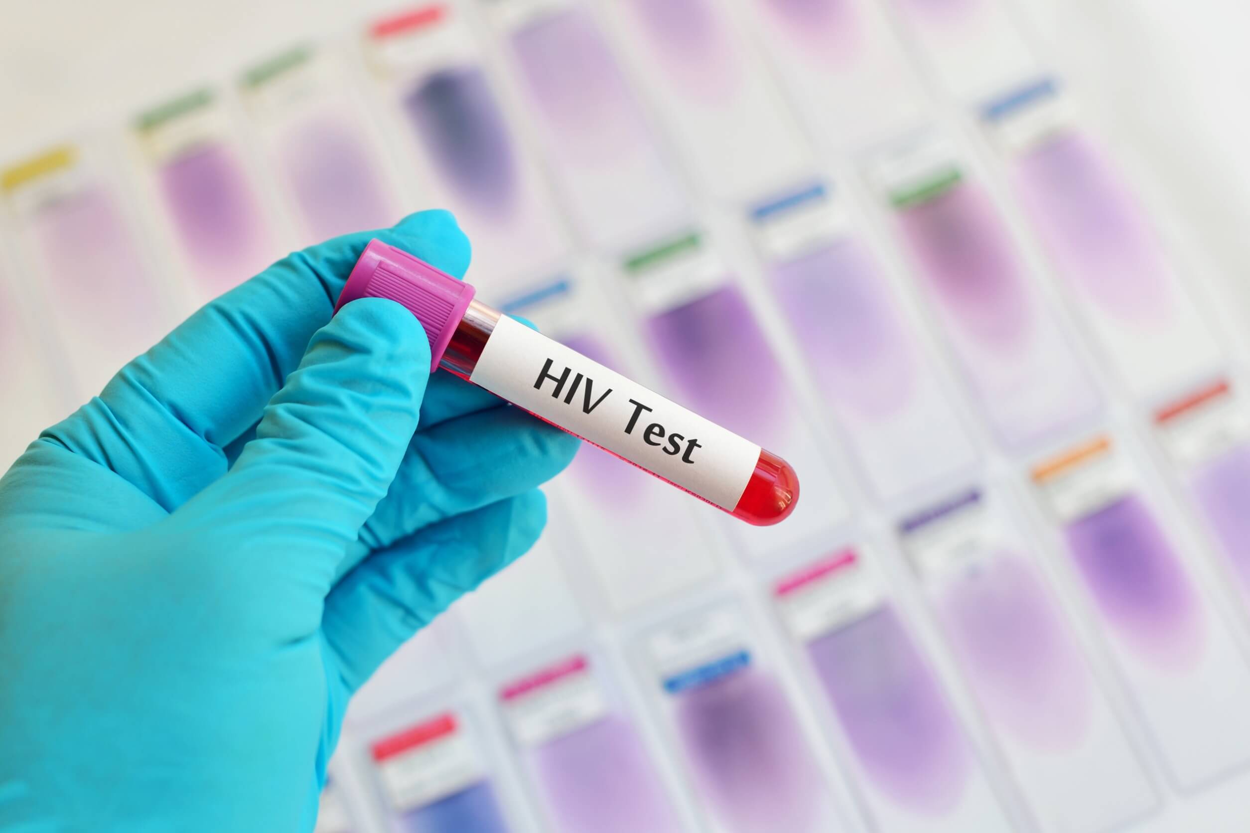 Blodprøve til undersøgelse for HIV